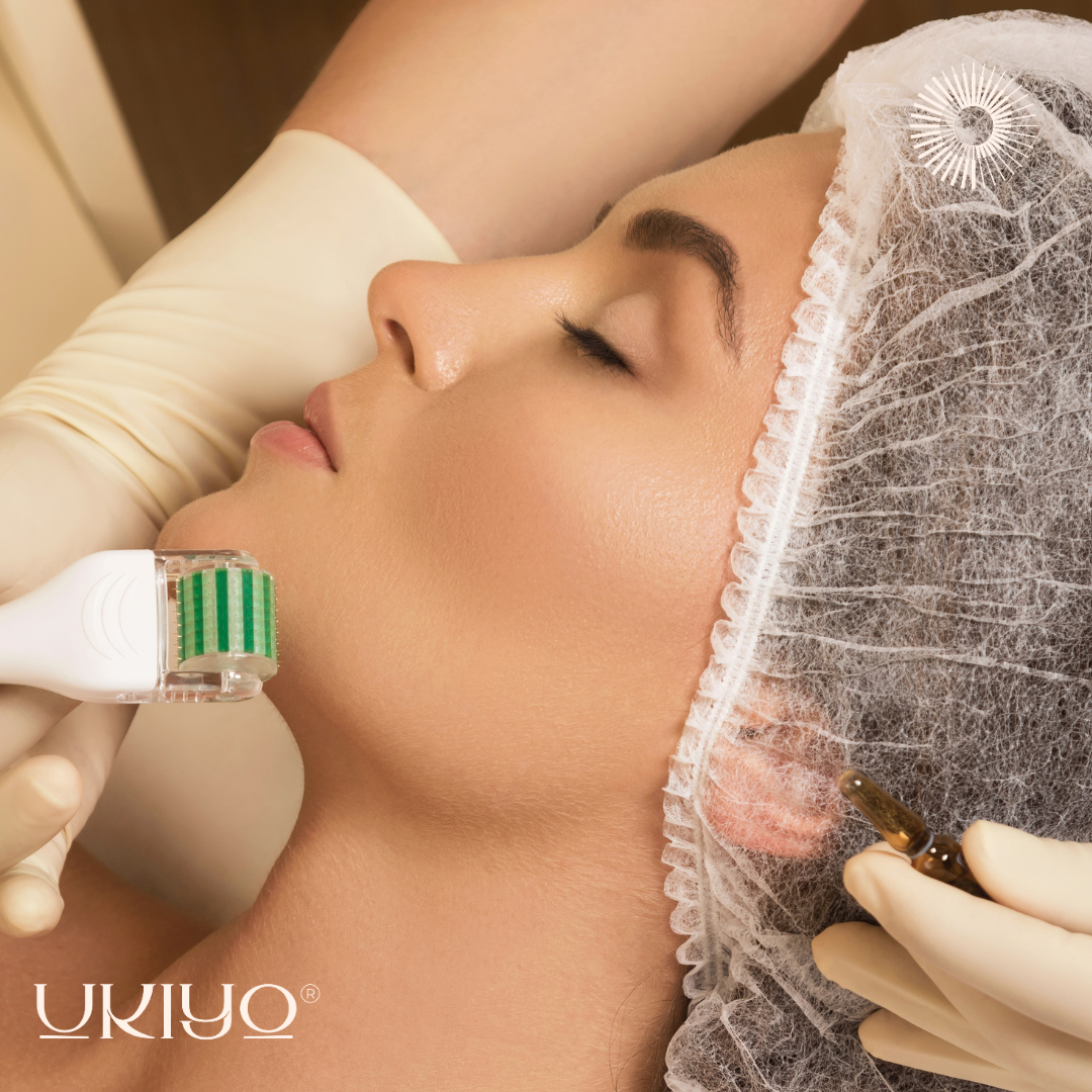 Microneedling